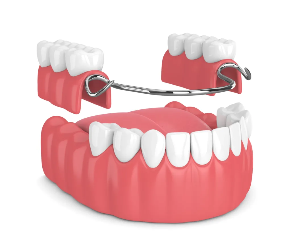 partial dentures round rock tx